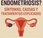 ¿Qué endometriosis? Síntomas, causas tratamientos explicado