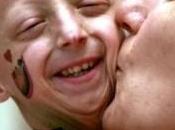 raro, enfermedades raras