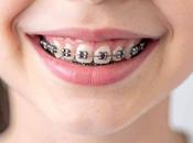 Ortodoncia infantil; guía para sonrisa saludable desde pequeños