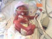 viaje invisible bebés prematuros familias, apoyado Pequeños Grandes Héroes