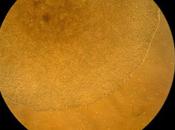 Prueban nuevos enfoques para tratar enfermedades autoinmunes.