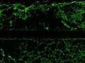 células madre pueden regenerar tejido cerebral después