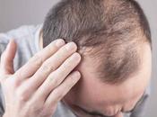 Xpecia Hombre, suplemento frena caída cabello refuerza crecimiento desde interior