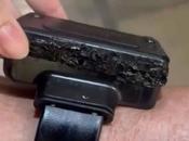 Bolsonaro alega «alucinación» «paranoia» para justificar intento abrir tobillera