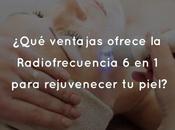 ¿Qué ventajas ofrece Radiofrecuencia para rejuvenecer piel?
