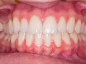 Clínica dental madrid: arturo soria, referente odontología integral