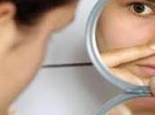 Trucos para combatir acné