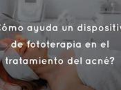 ¿Cómo ayuda dispositivo fototerapia tratamiento acné?