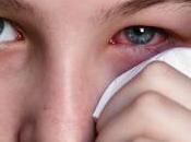 Aceite Girasol para Conjuntivitis
